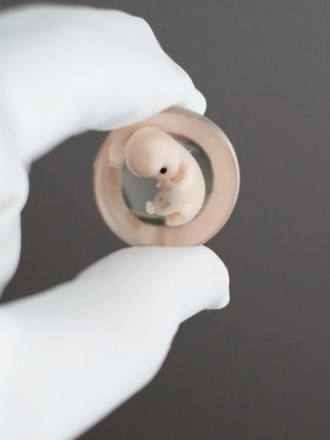 Embryo 7 weeks in Lens, 7 weeks pregnant, Sculpture cast in resin