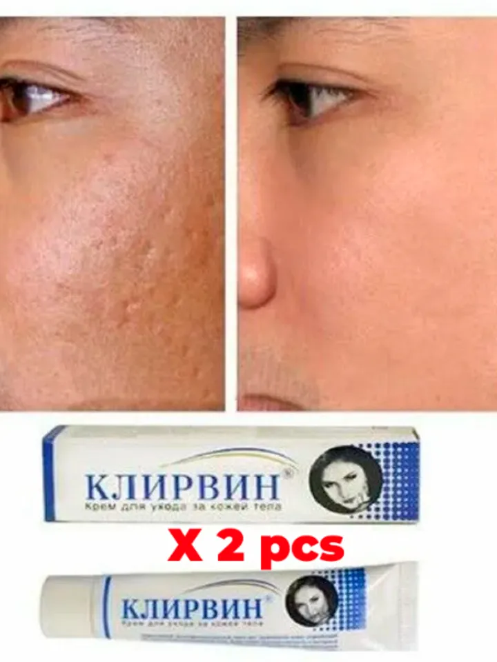 10 X KLIRVIN Cream Skin Care for Acne, Stretch Marks & Scars Restores skin, eliminates dark spots