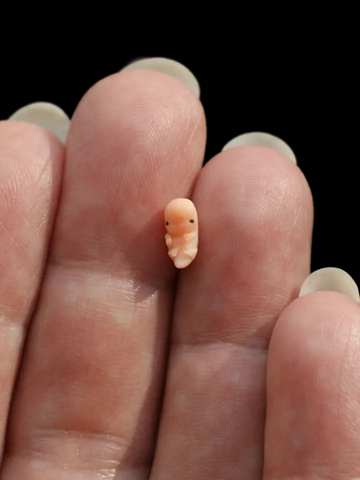 6 weeks of pregnancy. Embryonic Age 4 weeks