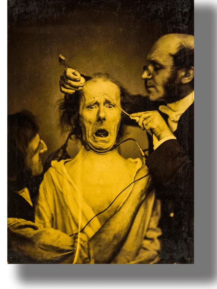 Terror mixed with pain. Frightening medical procedures in a psychiatric clinic.