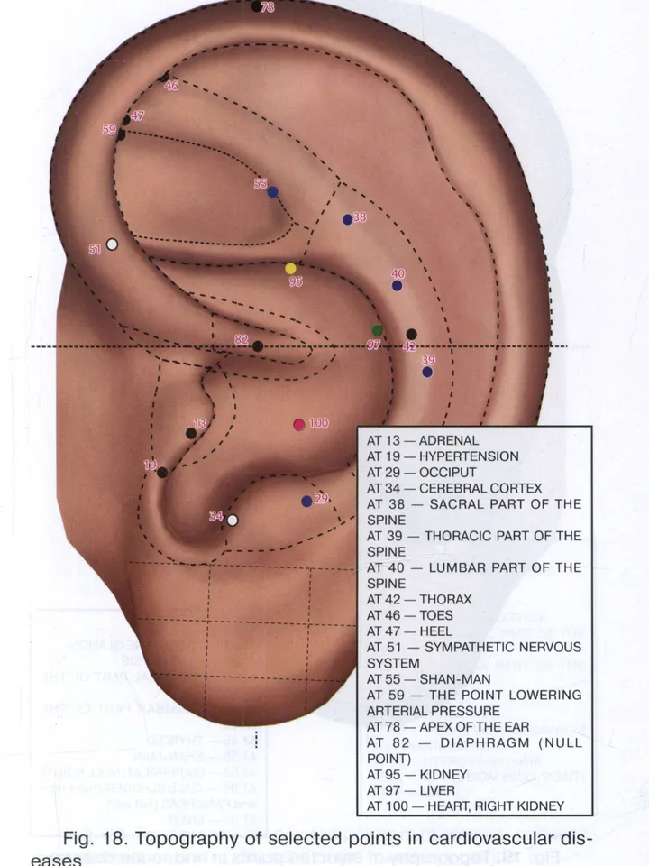 Point Probe - Remote electrode for acupuncture for Denas PCM, Scenar devices