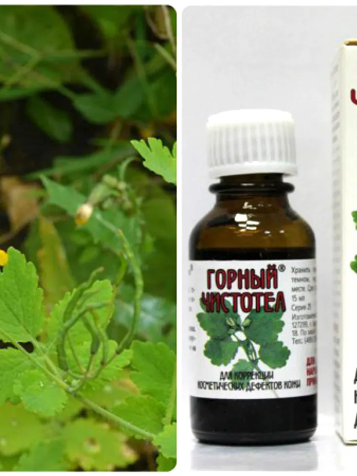 Mountain celandine for warts, papillomas, condylomas, calluses, corns, for the correction of cosmetic skin defects 15 ml