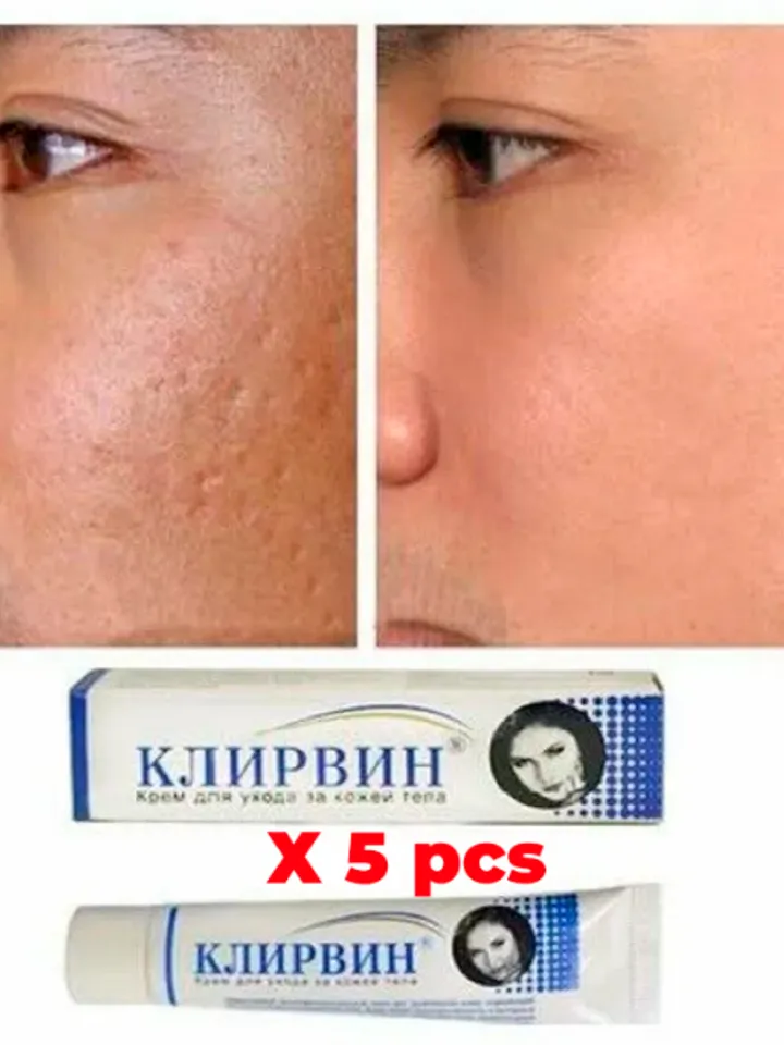 10 X KLIRVIN Cream Skin Care for Acne, Stretch Marks & Scars Restores skin, eliminates dark spots