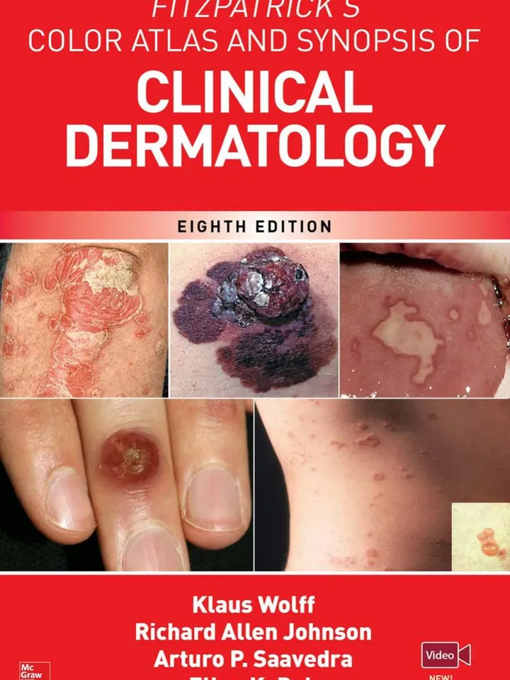 Fitzpatrick's Color Atlas AND SYNOPSIS OF CLINICAL DERMATOLOGY, 8th Ed 8th Edition by Klaus Wolff