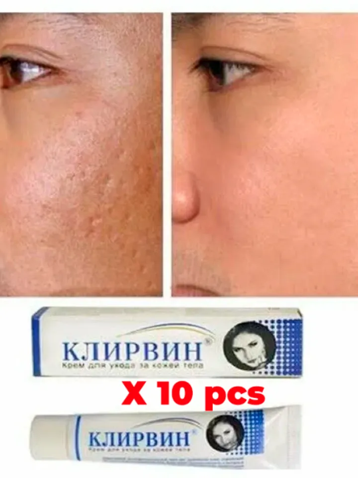 10 X KLIRVIN Cream Skin Care for Acne, Stretch Marks & Scars Restores skin, eliminates dark spots